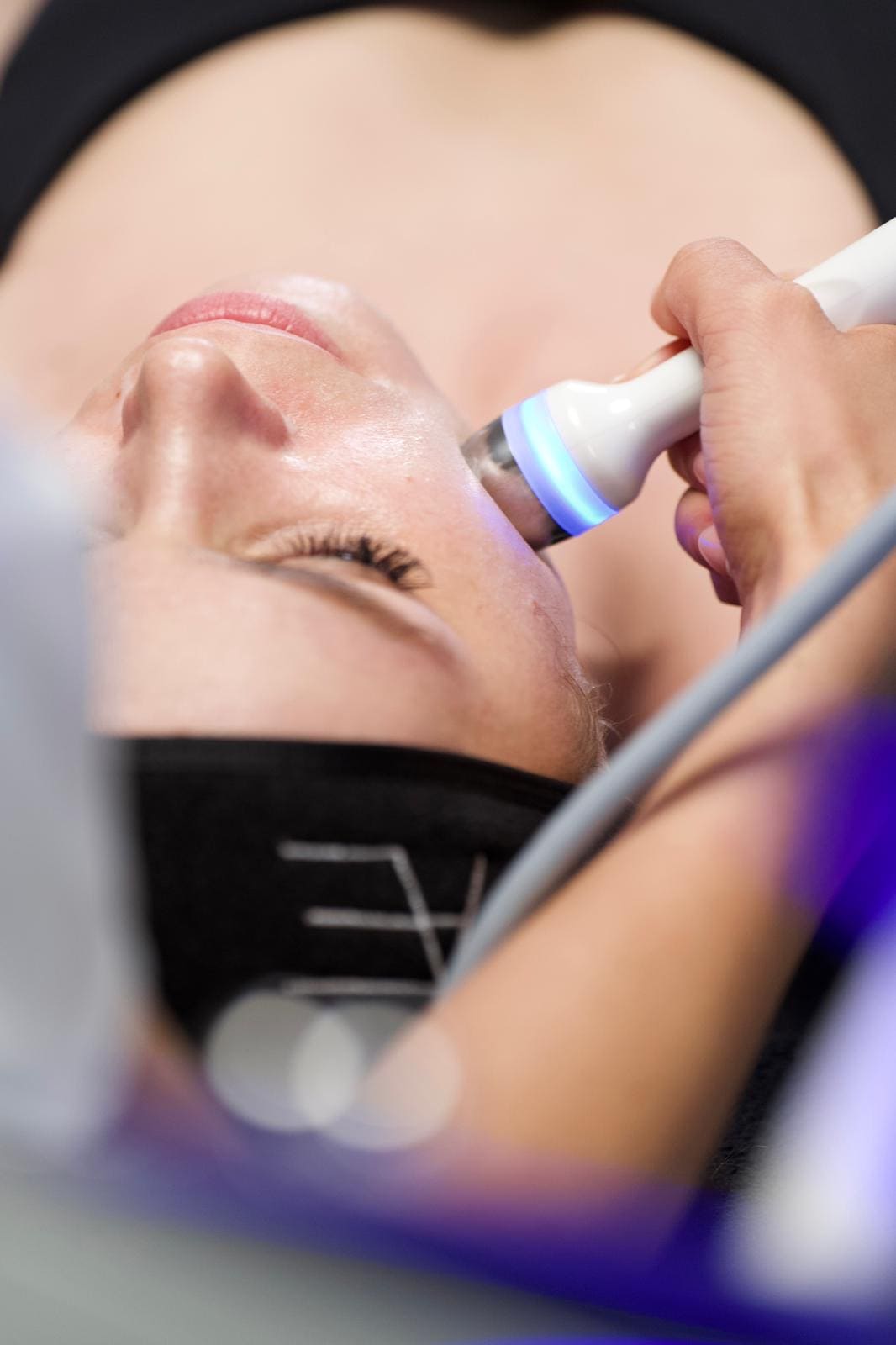 Lipocavitation Roncq